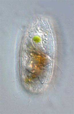 Coleps! En fascinerande ciliat som glider fram med hjälp av många små hårstrån och konsumerar bakterier för att överleva.