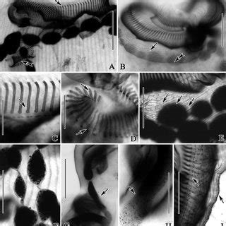  Heterotrichida! En mikrokosmos av unik morfologi och fascinerande beteende bland ciliater