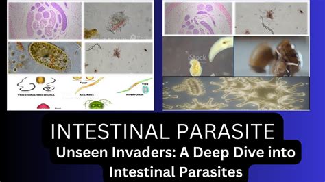 Intestinal Parasit! Ett djupt dyk i världen av Ichthyophthirius multifiliis och dess fascinerande parasitiska livsstil.