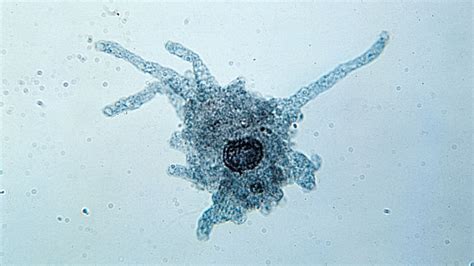  Ubiquitinated Amoeba - A Microscopic Marvel Embracing Both Solitary Life and Collaborative Foraging!